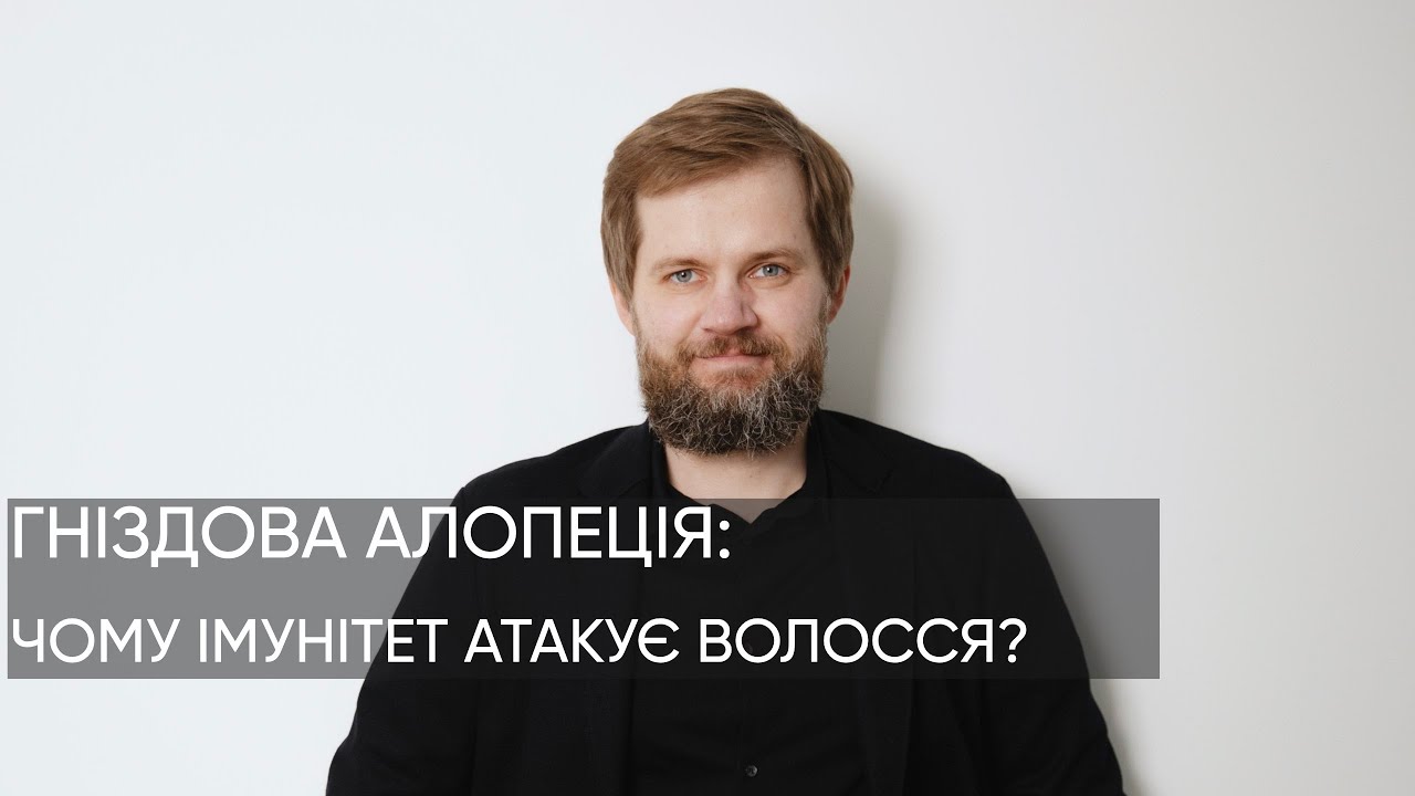 ВИПАДІННЯ ВОЛОССЯ ВОГНИЩАМИ