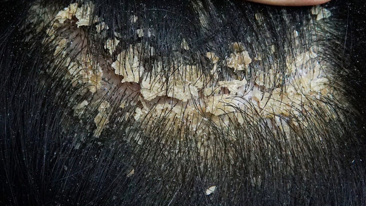 ASMR Super Comfortable Scalp Care #DMO3765