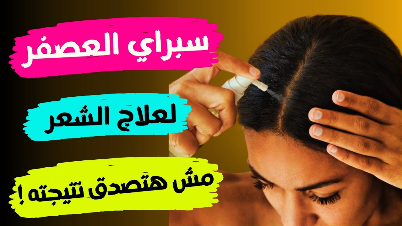 سبراي العصفر لعلاج تساقط الشعر | بديل المينوكسديل الافضل | نتيجة مذهلة