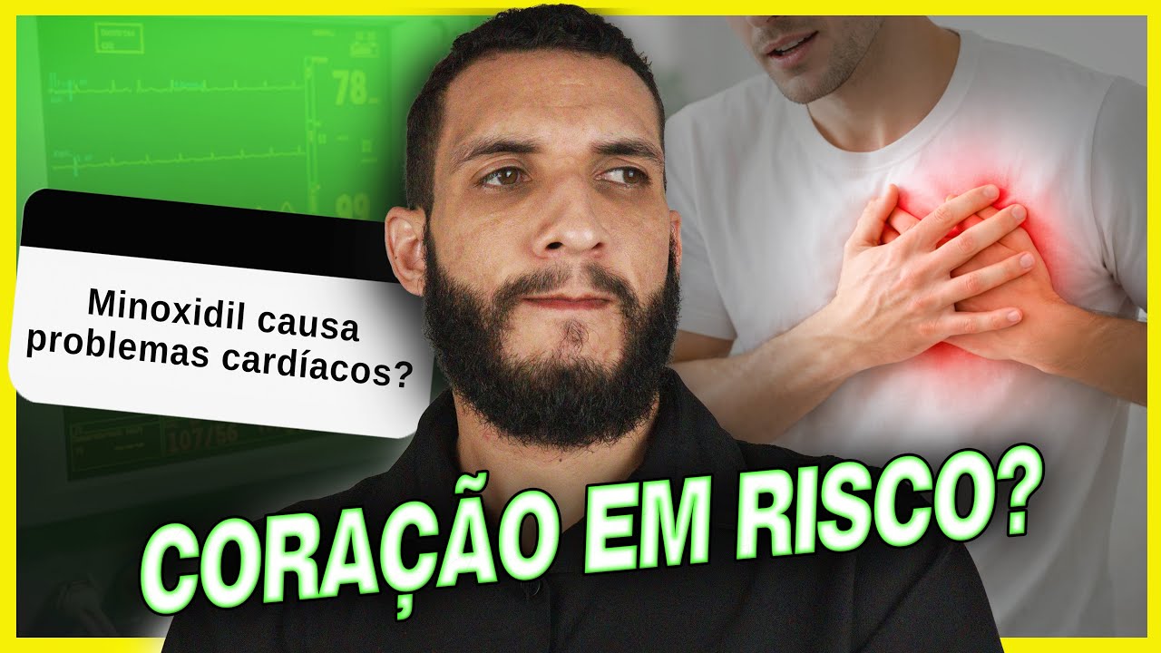 Minoxidil Causa Problemas Cardíacos? (respondendo perguntas) #2