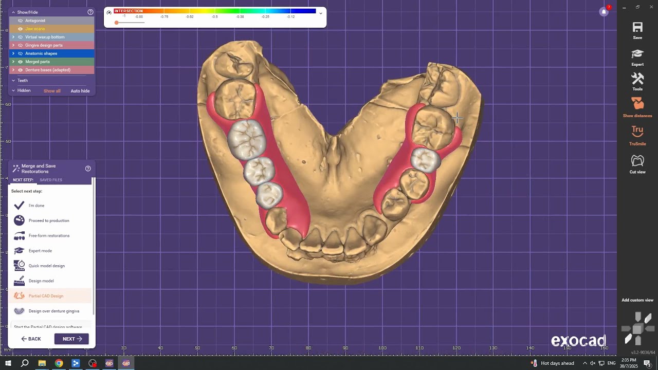 Exocad Flexible Denture Design For Lower Arch Split Base @ 2 Base