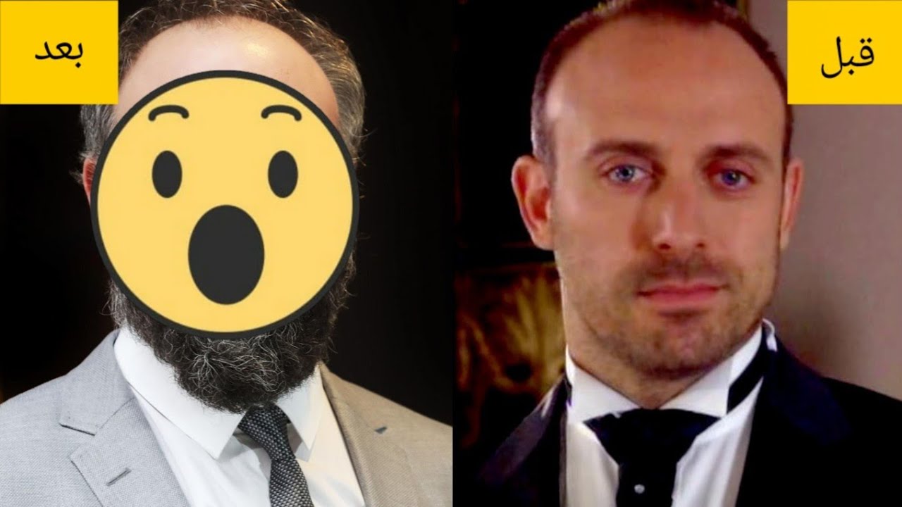 شاهد كيف أصبح شكل أبطال مسلسل ويبقى الحب بعد مرور 18 سنة على المسلسل 😍❤️