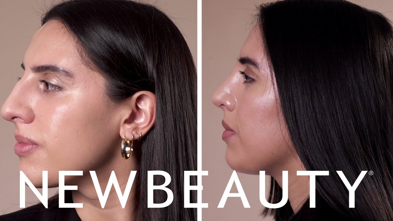 Inside A Rhinoplasty Surgery | Under The Surface