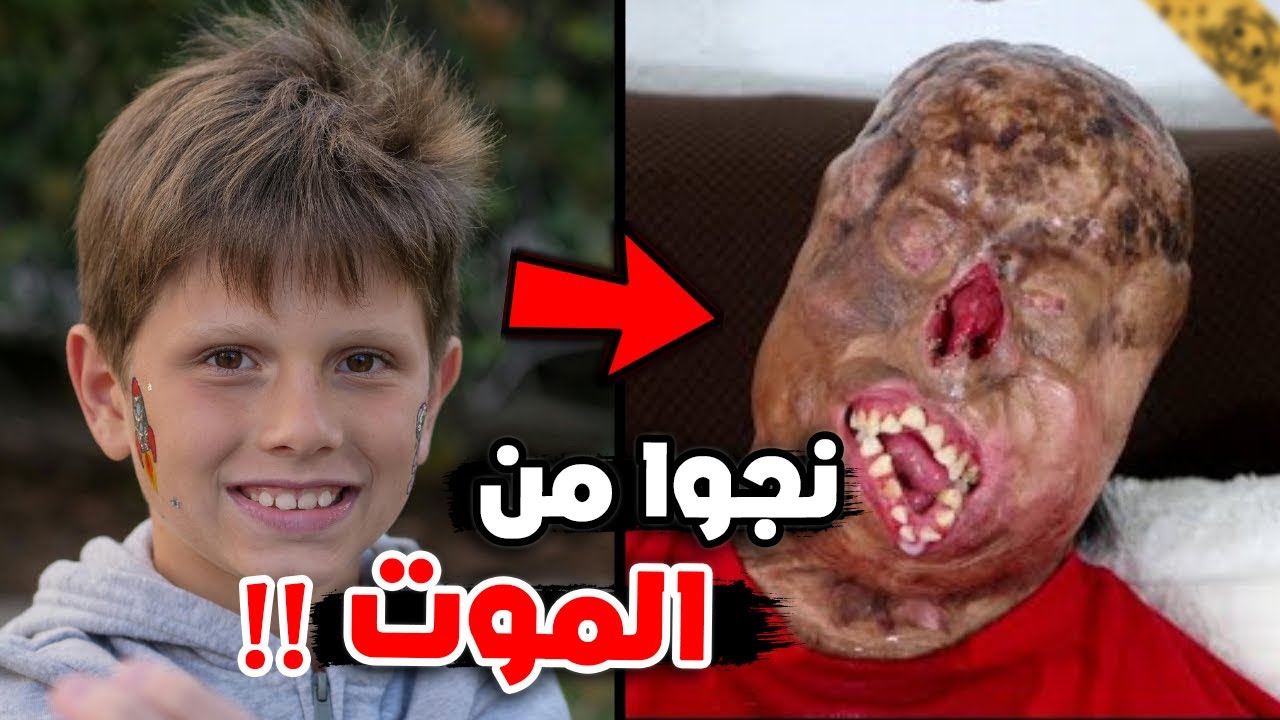 أشخاص نجوا من الموت بإعجوبة!!
