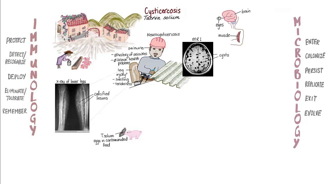 Helminths Springboard