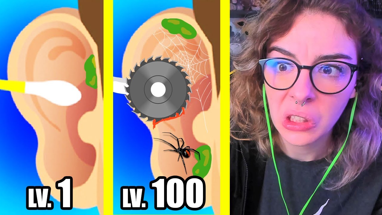 HO PULITO LE ORECCHIE ALLE PERSONE E CI HO TROVATO QUESTO - Earwax Clinic