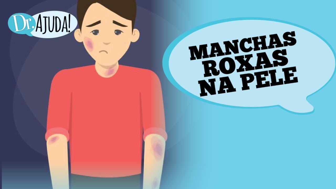 MANCHAS ROXAS NA PELE: O QUE PODE SER?