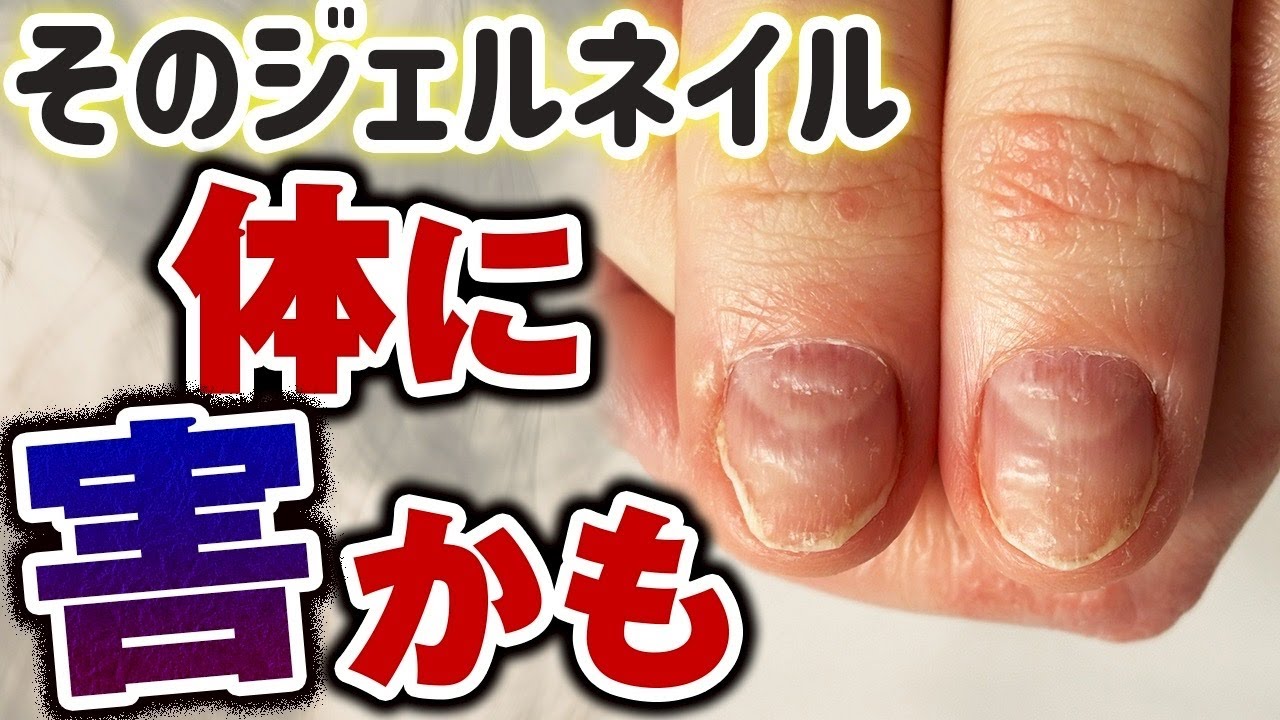【知らないと怖い…】ジェルネイル、できなくなってしまう前に気を付けて欲しいことをまとめました