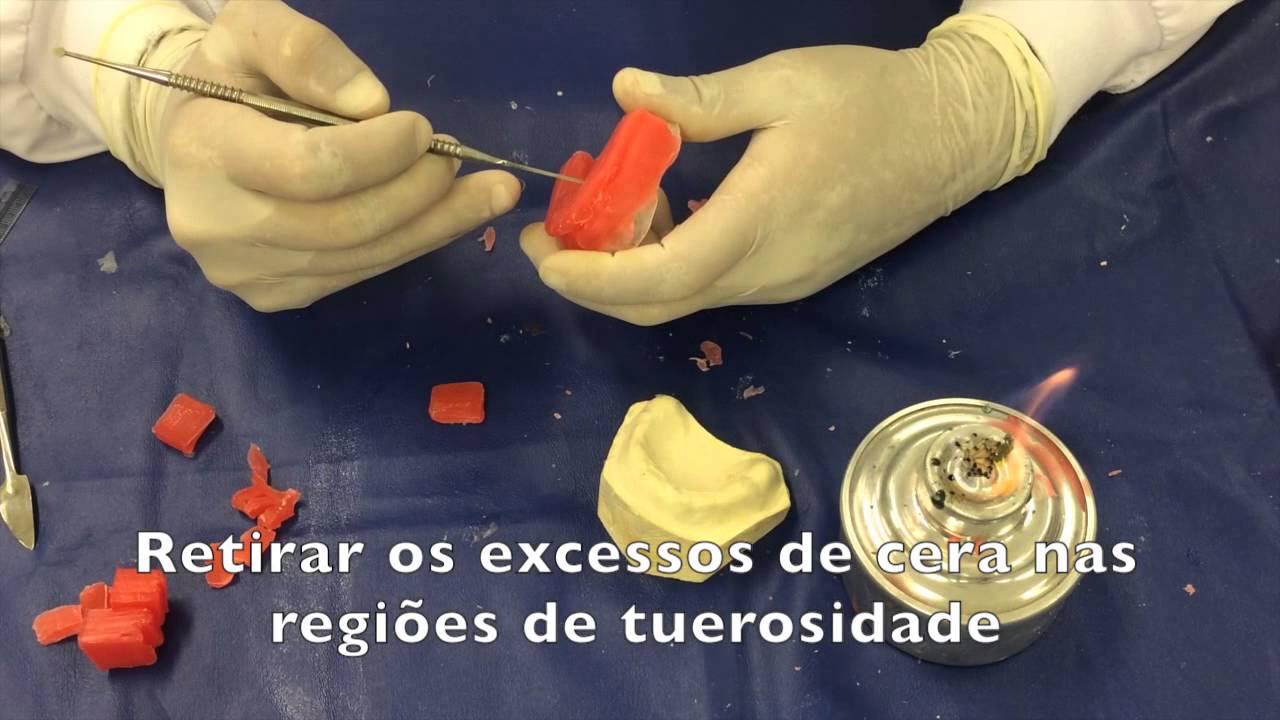 Prótese UCB - Base de prova e plano de orientação