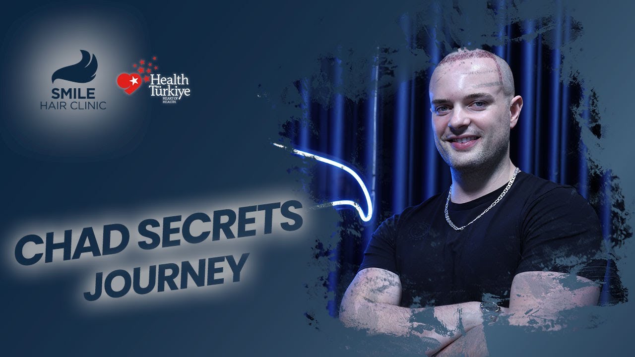 Chad Got A Hair Transplant in Turkey - Smile Hair Clinic with Dr. Mehmet Erdogan @ChadSecrets