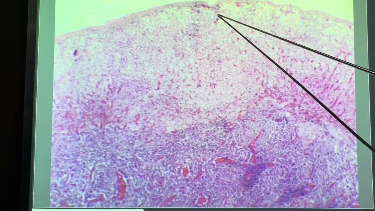 BIOL 158 Adrenal Gland Slide