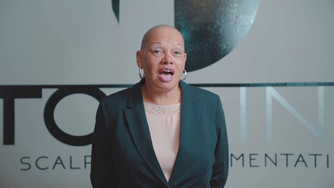 Topline Scalp Micropigmentation - Mrs. Parker's Testimonial (Female SMP Client)