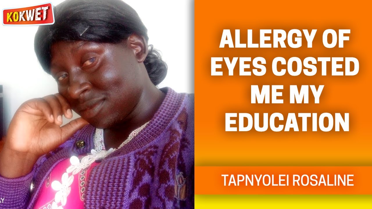 Allergy of Eyes Costed Me My Education - Tapnyolei Rosaline