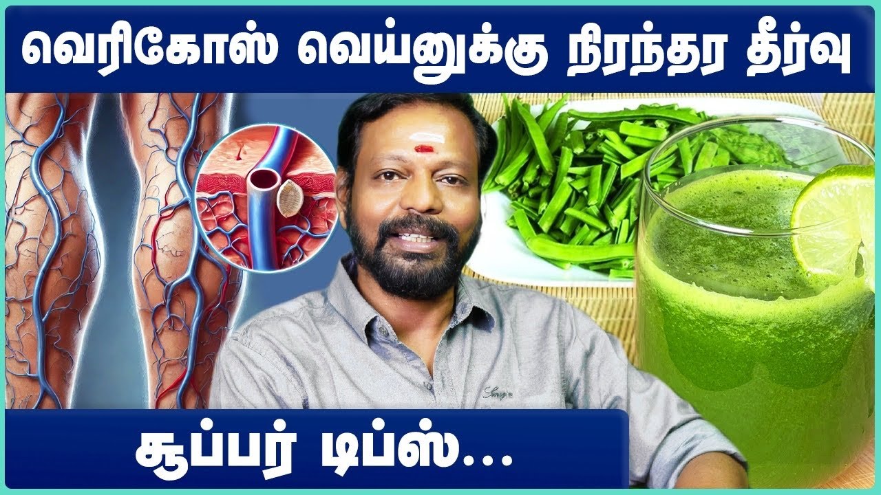 How to Treat Varicose Veins Naturally | வெரிகோஸ் வெயின் குணமாக | Mayan Senthil | Cosmo Health