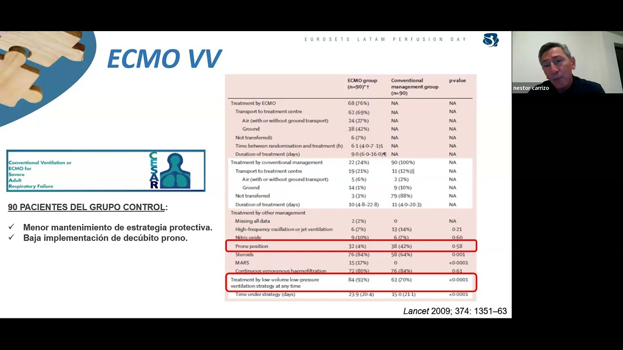 ECMO Club Day II - Eurosets VA (Veno Arterial)