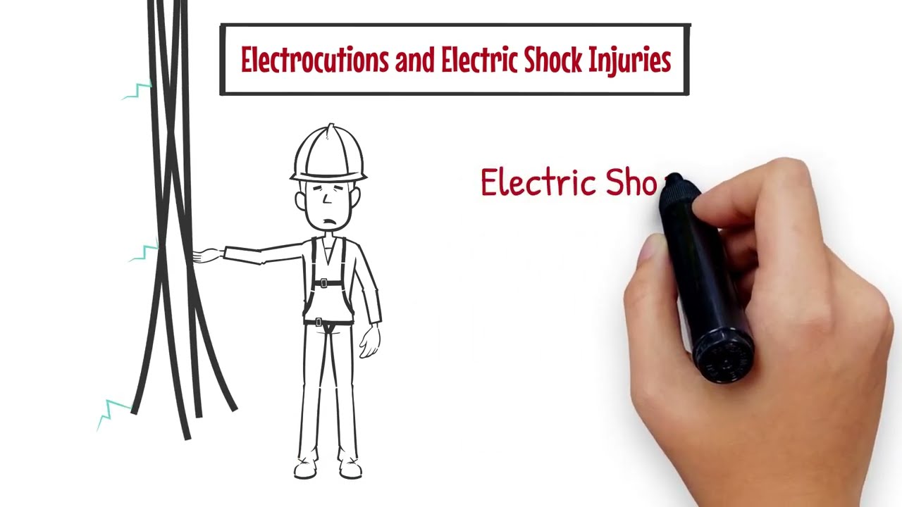 Electrocutions and Electric Shock Injuries