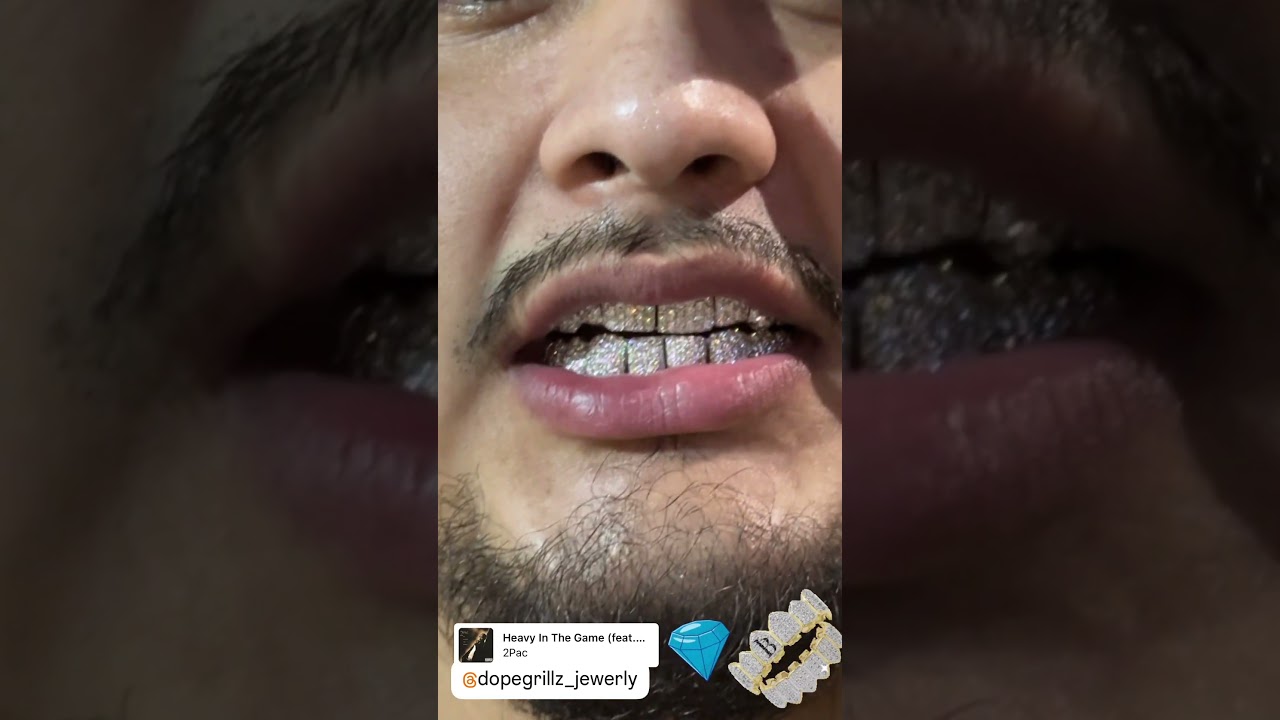 Lab Diamonds on Silver Grillz #goldteeth #grillz #jewelry #diamonddust #silvergrillz #labdiamonds