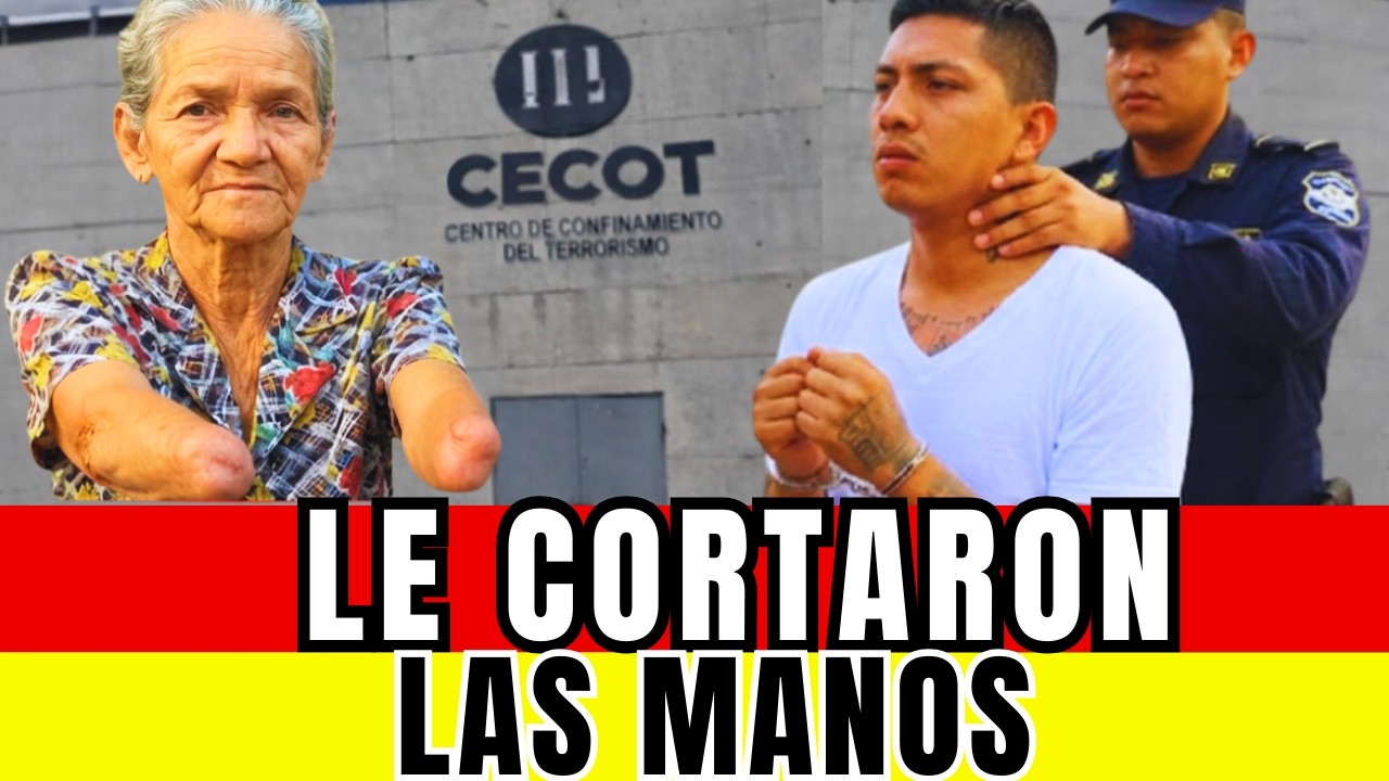 COBRARON RENTA A SU PROPIA TÍA… Y LA DEJARON SIN MANOS
