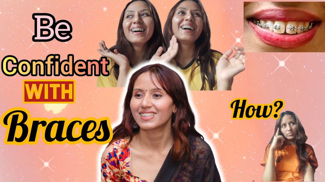 How to Be Confident with Braces? Teeth Transformation Journey #mybracesjourney #viral #braces 