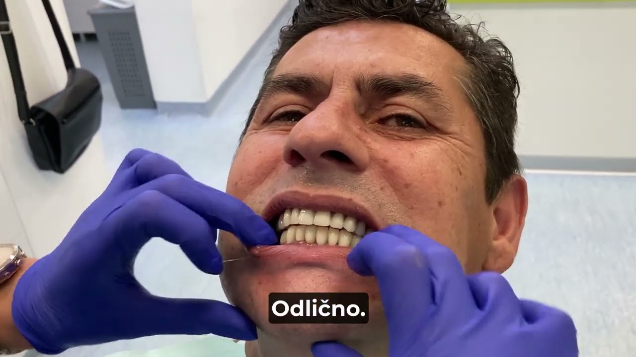 Proba zuba nakon ugradnje implantata