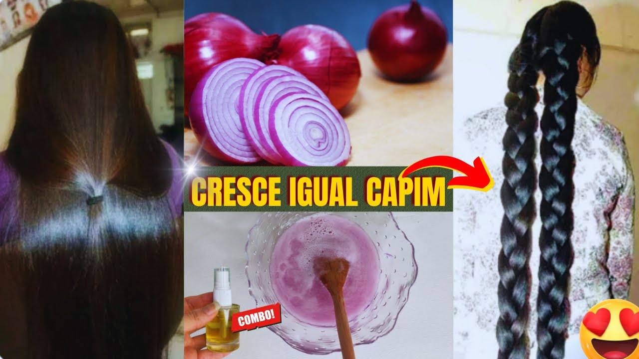 NÃO USE MUITO - CABELO CRESCE RÁPIDO COM TÔNICO DE CEBOLA ROXA E AZEITE  #crescimentocapilar #cabelo