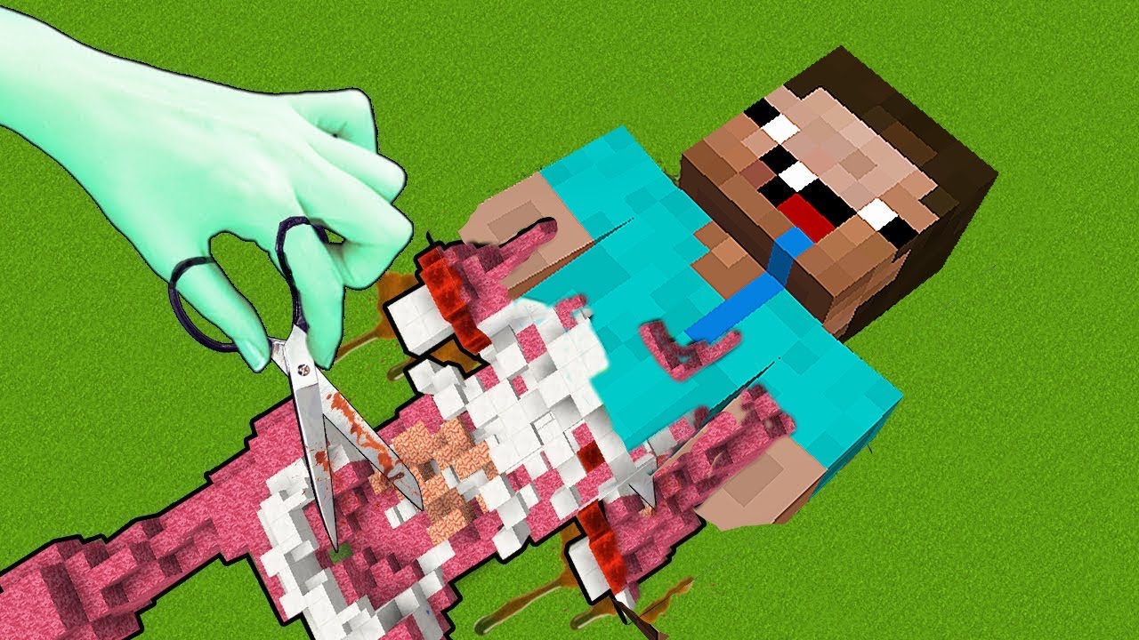 ¿NOOB PODRÁ SOBREVIVIR A LA OPERACIÓN? - MINECRAFT TROLL