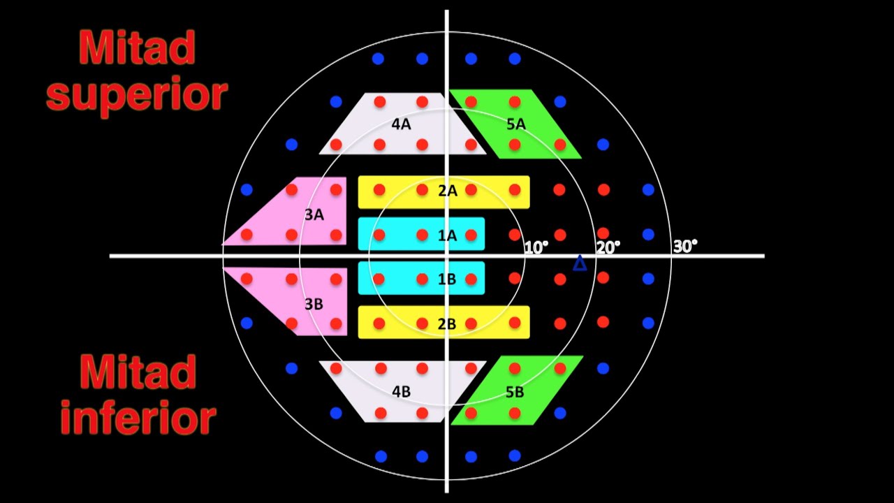 Interpretación del campo visual V: Prueba de Hemicampo para Glaucoma (PHG)