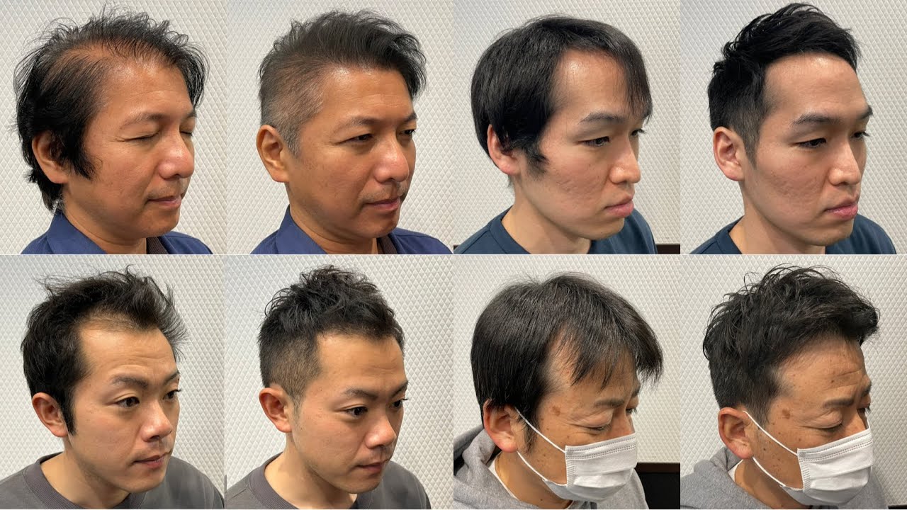 【はげ薄毛】薄毛が目立たない理想のヘアスタイルに大変身！