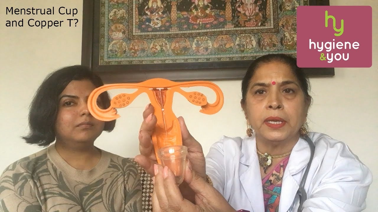 Menstrual cup with copper T / IUD; Doctors Opinion 