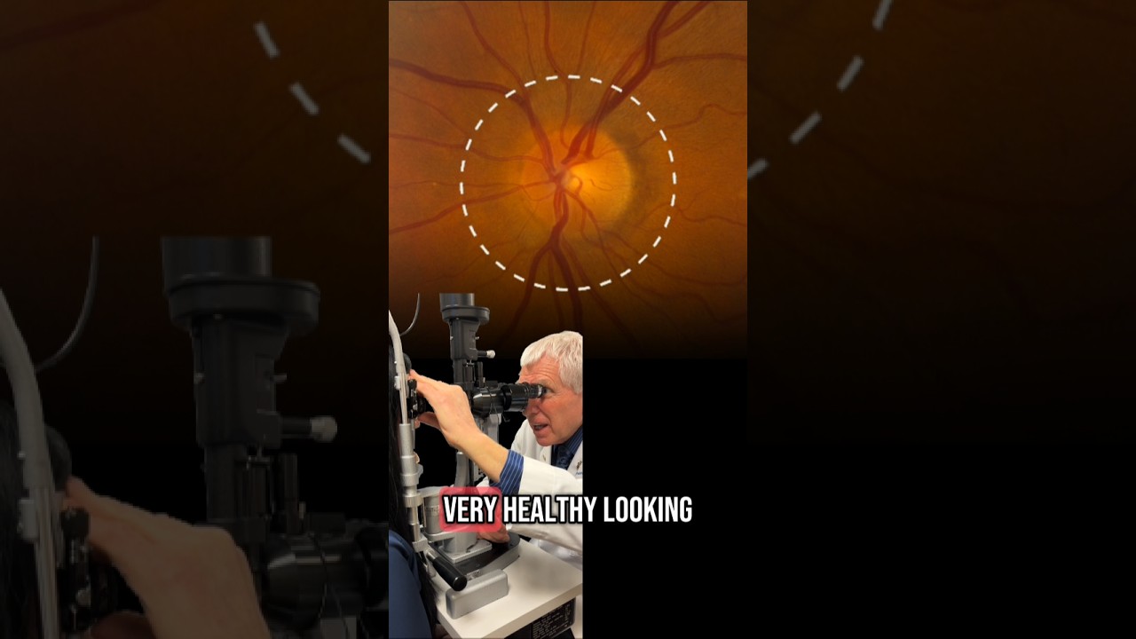 What Your Eye Doctor Sees During Your Eye Exam | Dr. Frank Edmunds Explains #eyedoctorutah #eyeexam