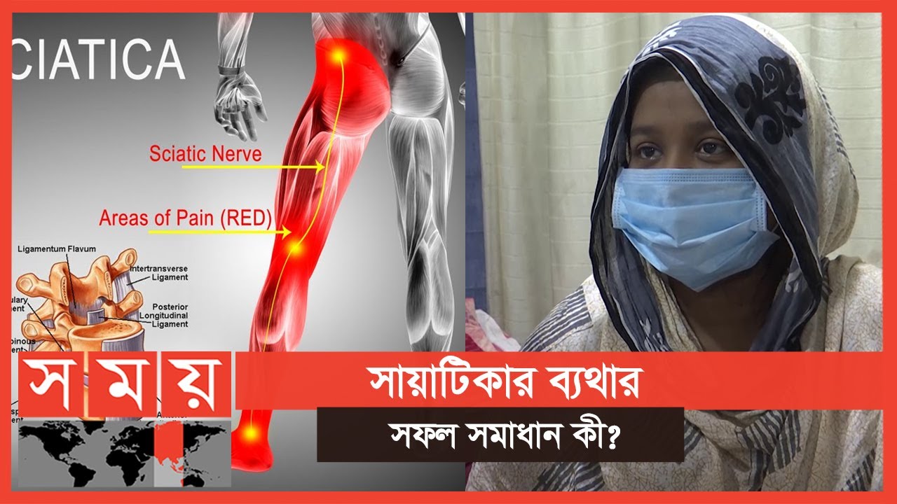 কোমর ব্যথাও কেড়ে নিতে পারে হাঁটা চলার শক্তি | বদ্যি বাড়ি | Boddi Bari | Sciatica