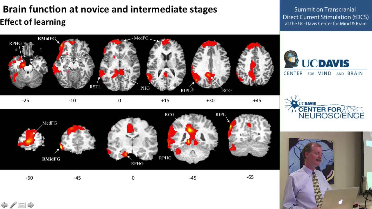 TDCS for Cognitive Enhancement