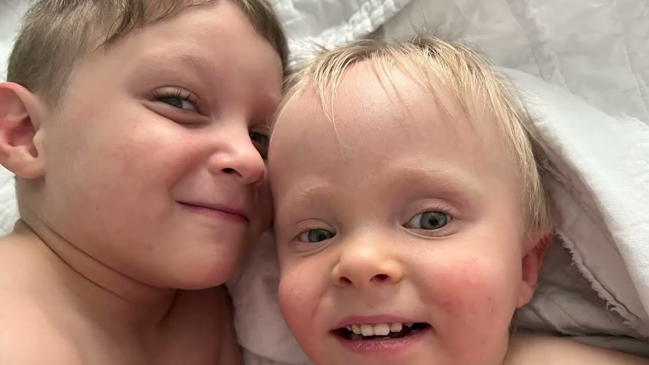 Coats Plus Syndrome: A Story of Two Brothers With Same Rare Genetic Condition