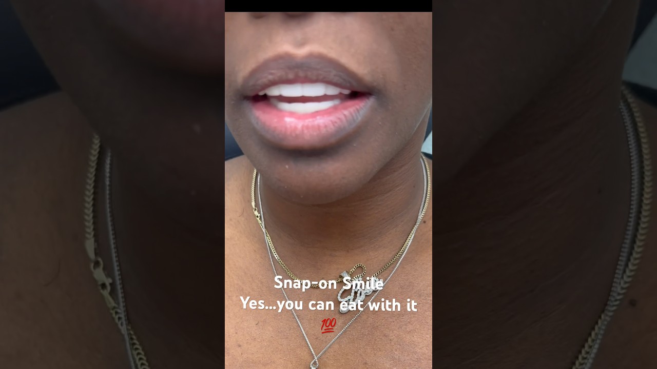 Самый задаваемый вопрос! Можно ли есть с Snap-on Smile? Посмотрите!