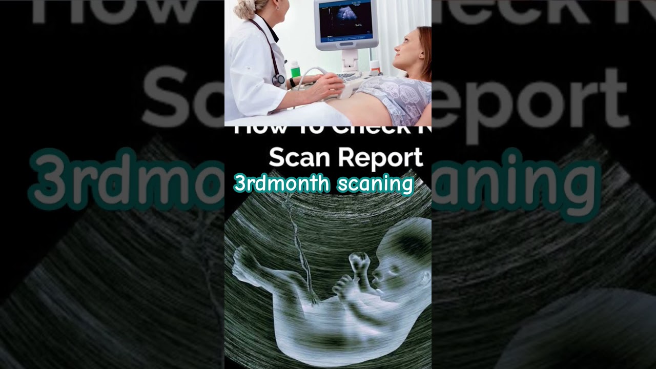 duringpregncy 3rdmonth scaning #ntscan #pregencycare #ytshort #viral#newvideo #trendingshort