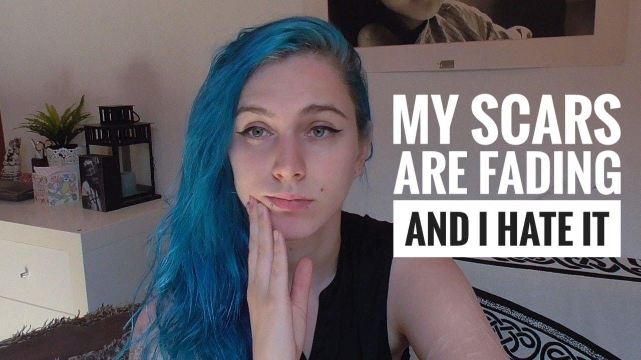 My scars are fading and I hate it... Why? | Selfharmerproblems