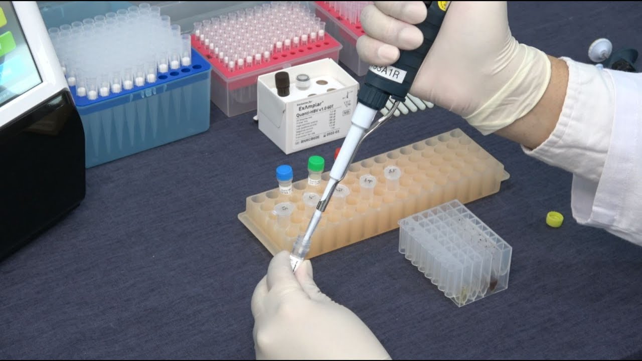 NuActor and ExAmplar HBV - Test Procedure
