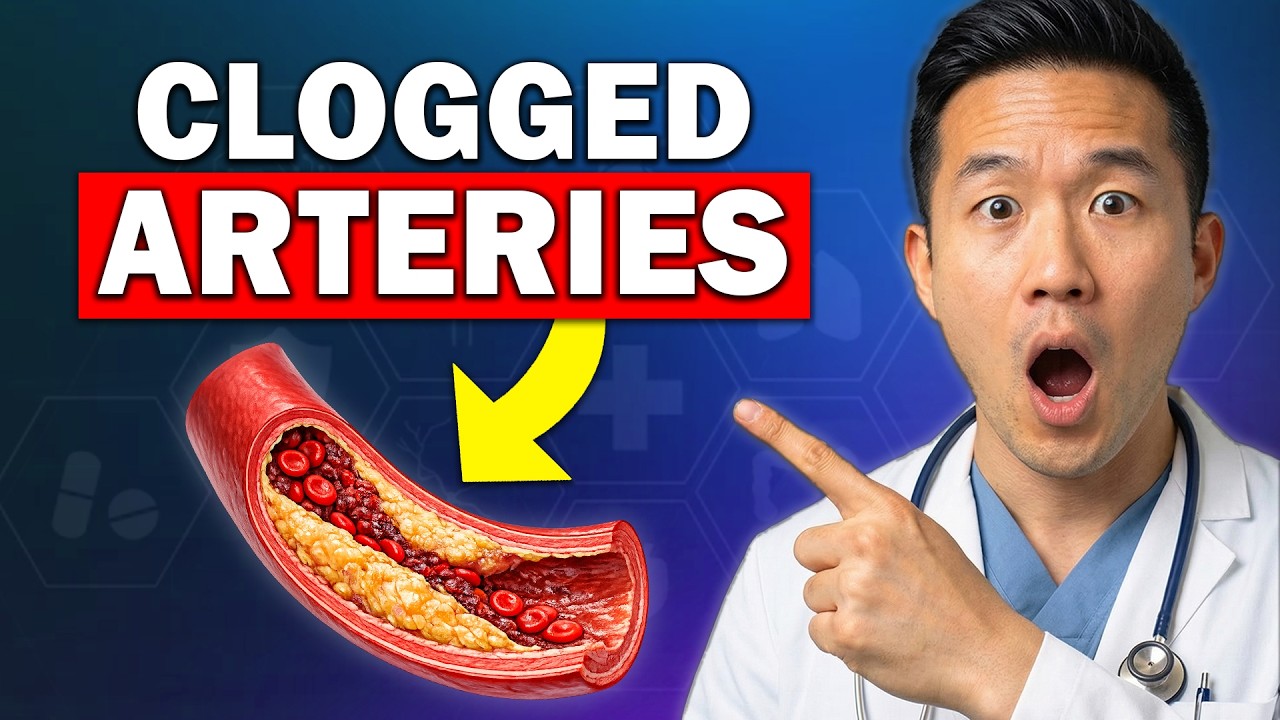 The REAL Reason Your Arteries Get Clogged (It’s Not What You Think)