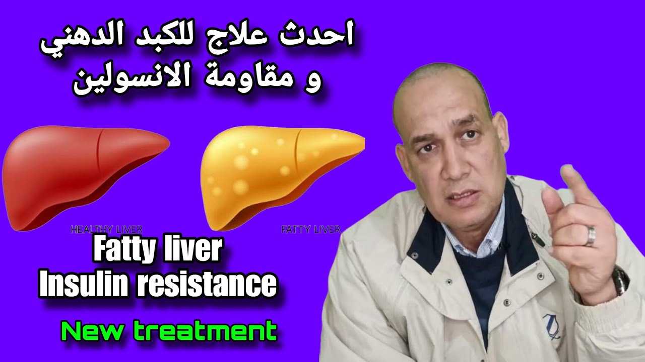 احدث علاج للكبد الدهني و مقاومة الانسولين. New treatment for fatty liver and insulin resistance