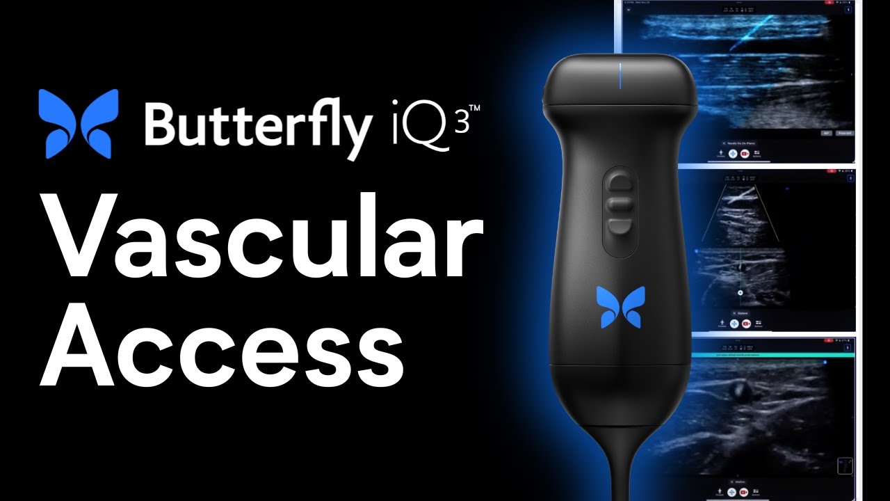 The Perfect Probe for Vascular Access | Butterfly Network