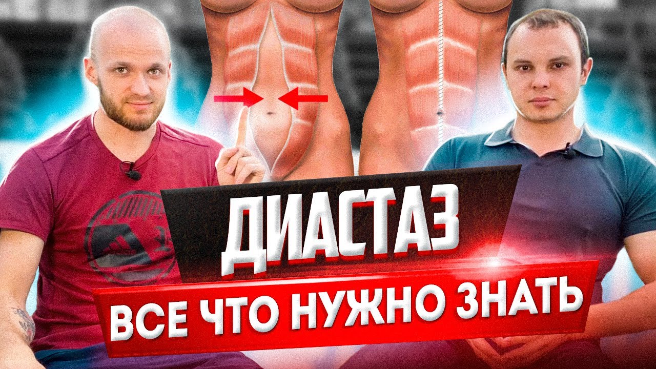 Упражнения при диастазе, тренер и врач! Как укрепить поперечную мышцу живота. Все что нужно знать!