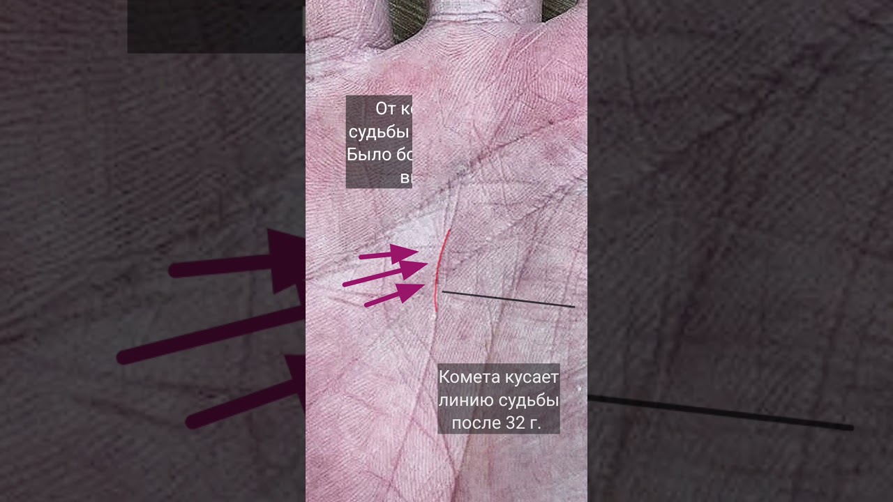 Сложный период на линии судьбы#хирология
