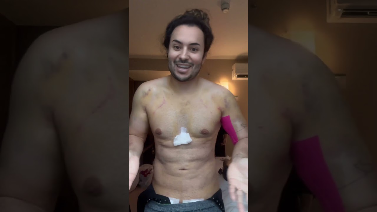Обновления LIPO HD! #макияж #lipohd #липосакция