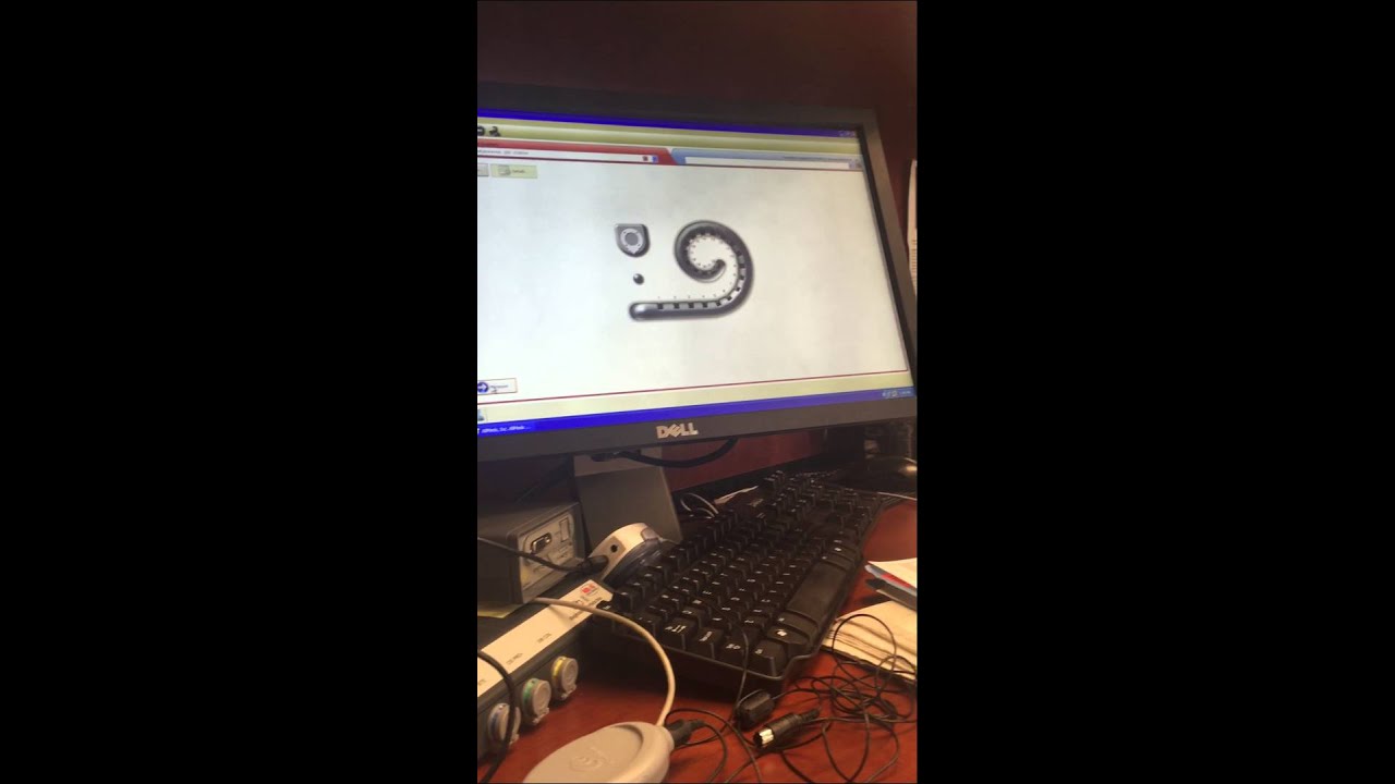 Cochlear Implant Mapping Part 1