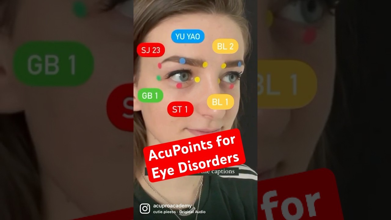 Acupuncture Points for EYE disorders