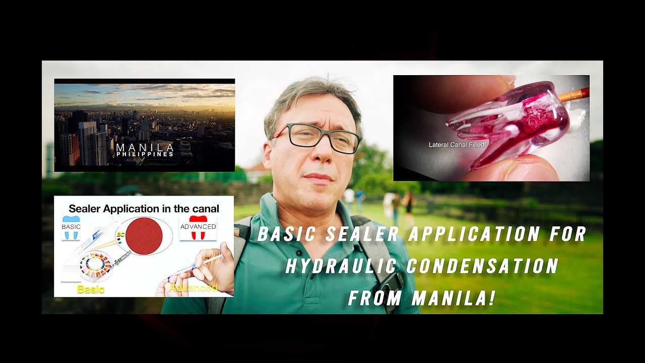Basic and Advanced Hydraulic Condensation from Manila
