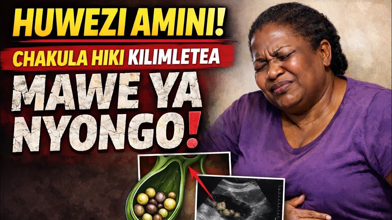 Madaktari Walishangaa! Chakula Hiki Kilimsababishia Mawe ya Nyongo