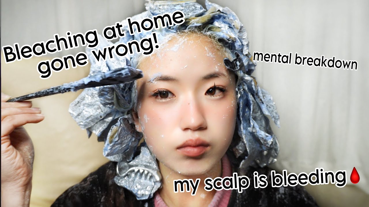 BLEACHING MY HAIR AT HOME WENT HORRIBLY WRONG!(bleach burn,blood, scabs and healing)