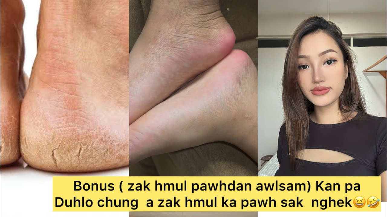 Ke sir chhia no nalh tak a chhuah ngei2 dan.. ka ke ka enkawl dan, hautak lo leh thawk tha em2 si 😅.