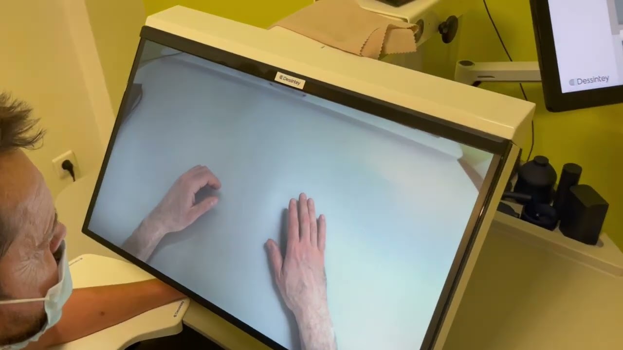 Physiotherapy 11 months after arm transplant